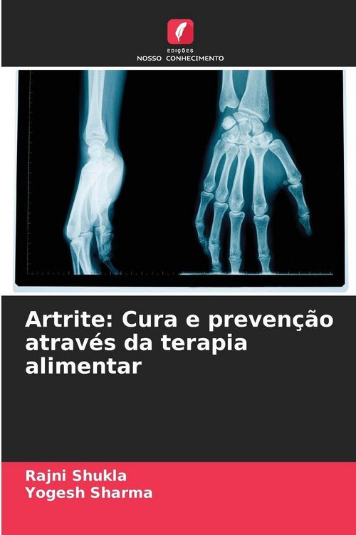 Produktbild: Artrite: Cura e preven&ccedil;&atilde;o atrav&eacute;s da terapia alimentar