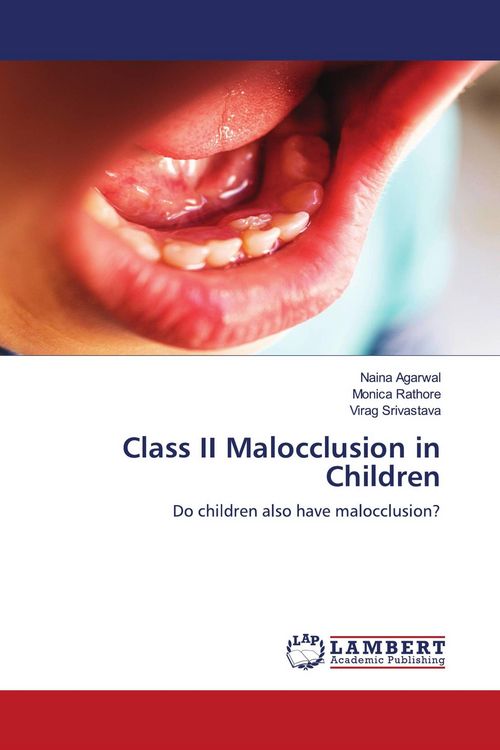 Produktbild: Class II Malocclusion in Children