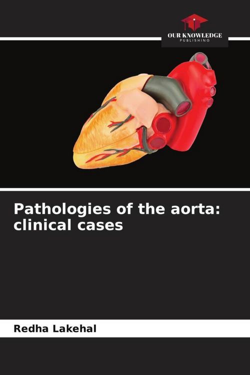 Produktbild: Pathologies of the aorta: clinical cases