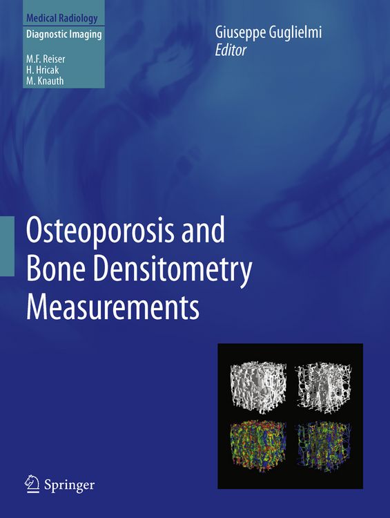 Produktbild: Osteoporosis and Bone Densitometry Measurements