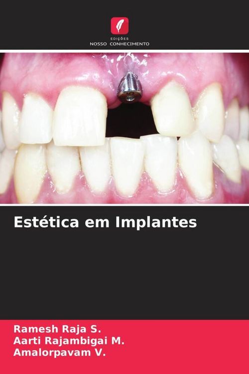 Produktbild: Est&eacute;tica em Implantes
