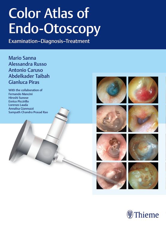 Produktbild: Color Atlas of Endo-Otoscopy