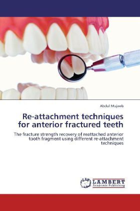 Produktbild: Mujeeb, A: Re-attachment techniques for anterior fractured t