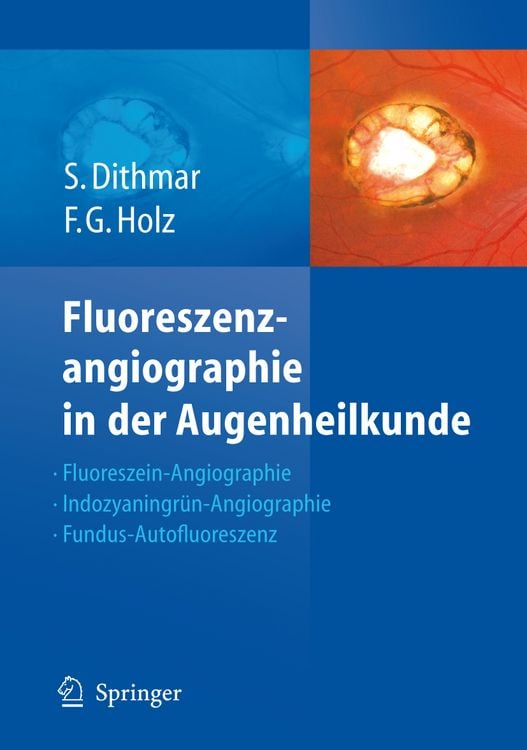 Produktbild: Fluoreszenzangiographie in der Augenheilkunde