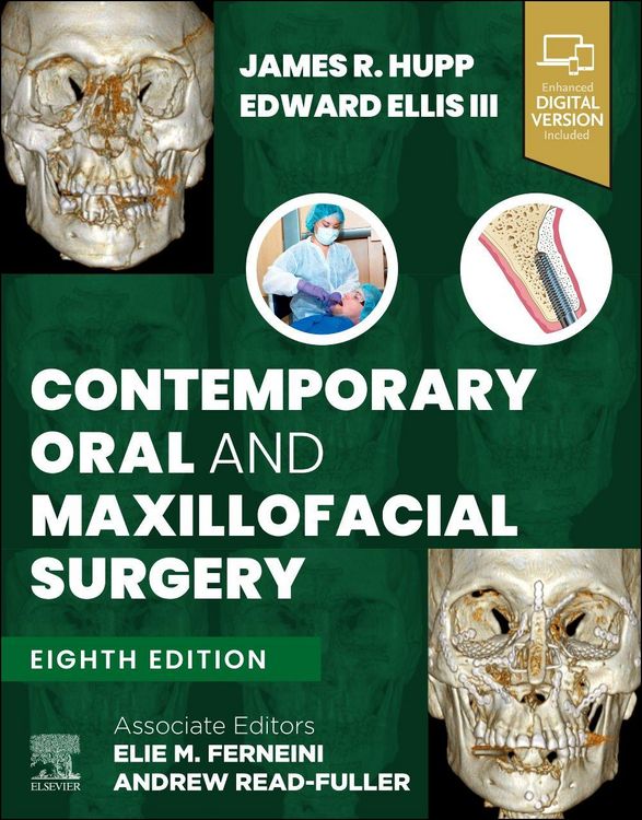 Produktbild: Contemporary Oral and Maxillofacial Surgery