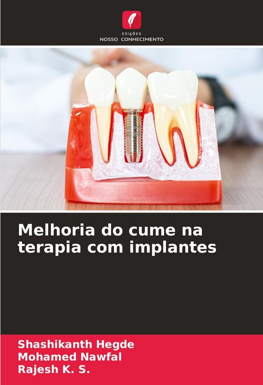Produktbild: Melhoria do cume na terapia com implantes