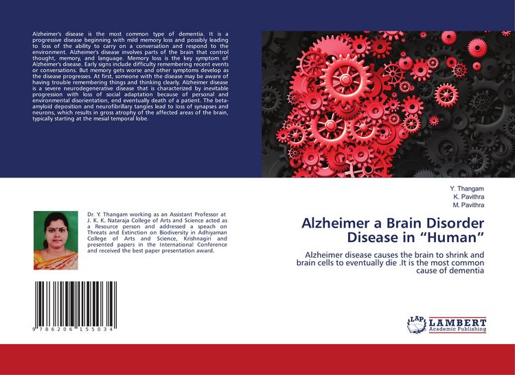 Produktbild: Alzheimer a Brain Disorder Disease in "Human"