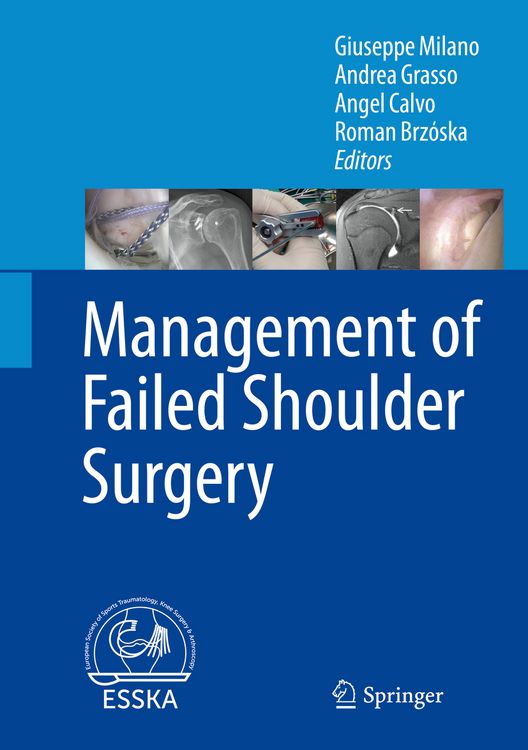 Produktbild: Management of Failed Shoulder Surgery