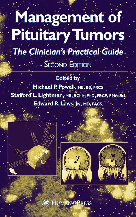 Produktbild: Management of Pituitary Tumors