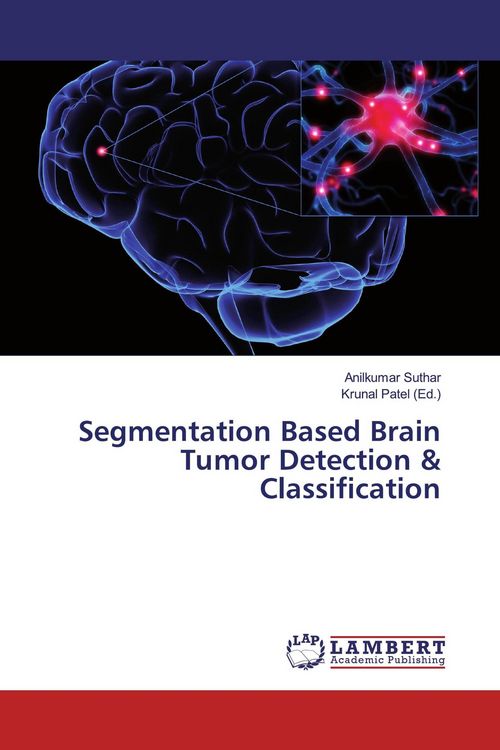 Produktbild: Segmentation Based Brain Tumor Detection & Classification