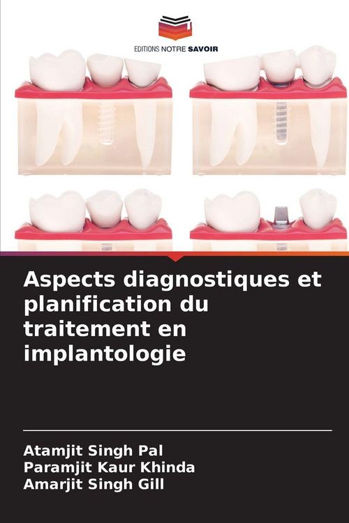 Produktbild: Aspects diagnostiques et planification du traitement en implantologie