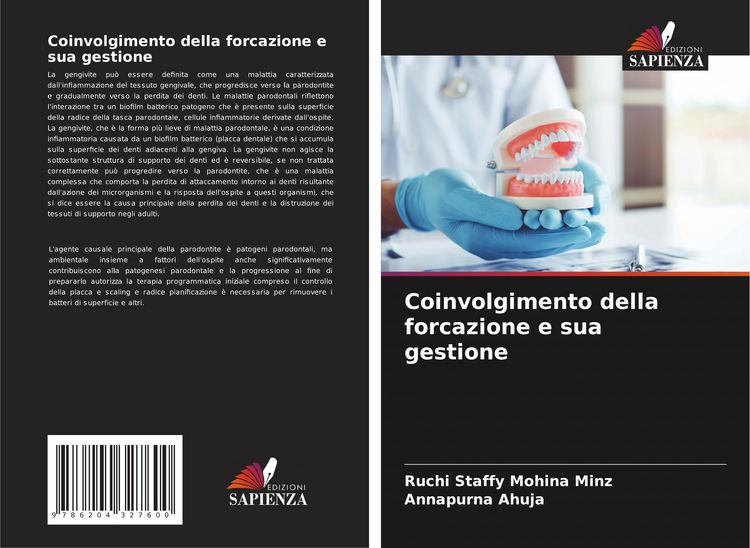 Produktbild: Coinvolgimento della forcazione e sua gestione