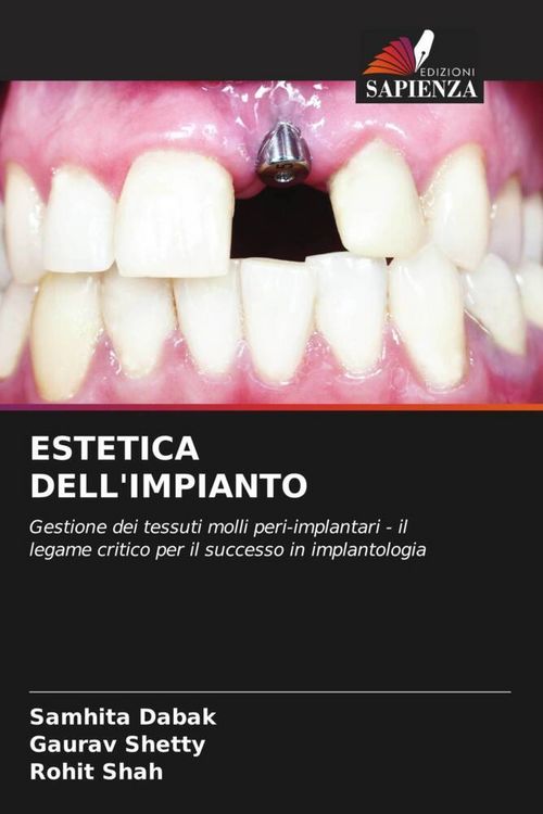 Produktbild: Estetica Dell'impianto