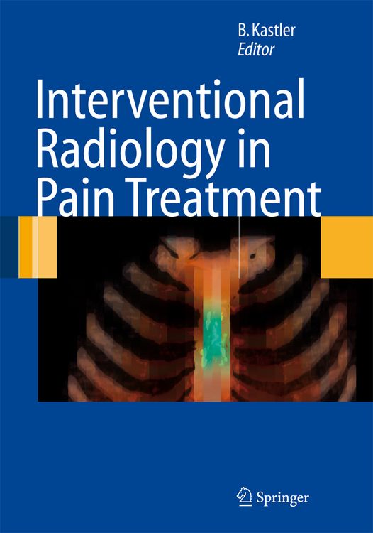 Produktbild: Interventional Radiology in Pain Treatment