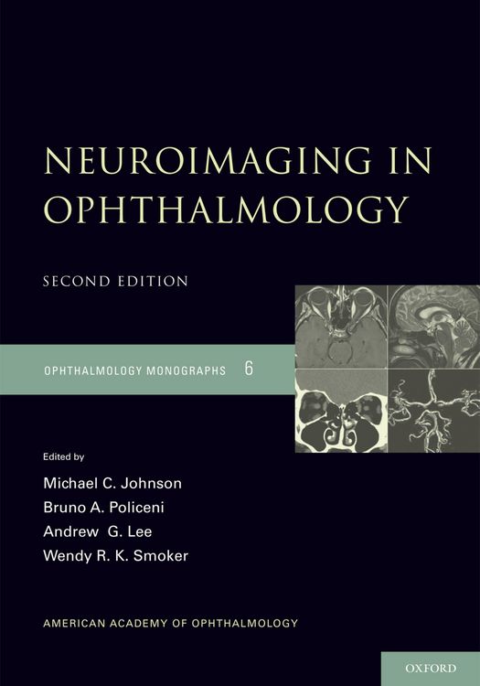 Produktbild: Neuroimaging in Ophthalmology