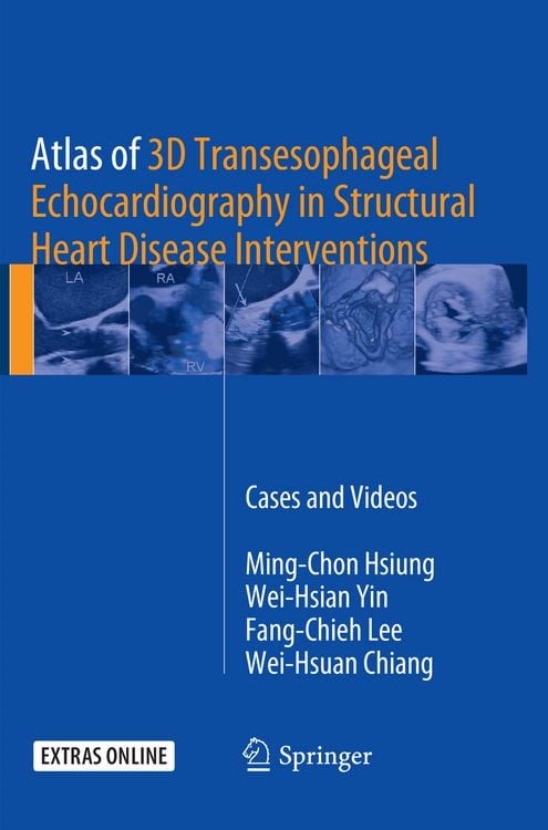 Produktbild: Atlas of 3D Transesophageal Echocardiography in Structural Heart Disease Interventions