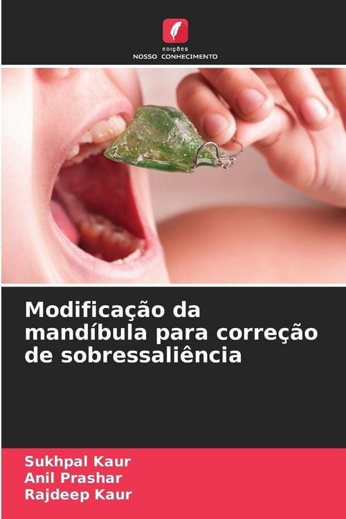 Produktbild: Modifica&ccedil;&atilde;o da mand&iacute;bula para corre&ccedil;&atilde;o de sobressali&ecirc;ncia