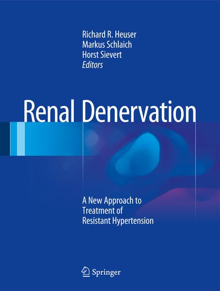 Produktbild: Renal Denervation