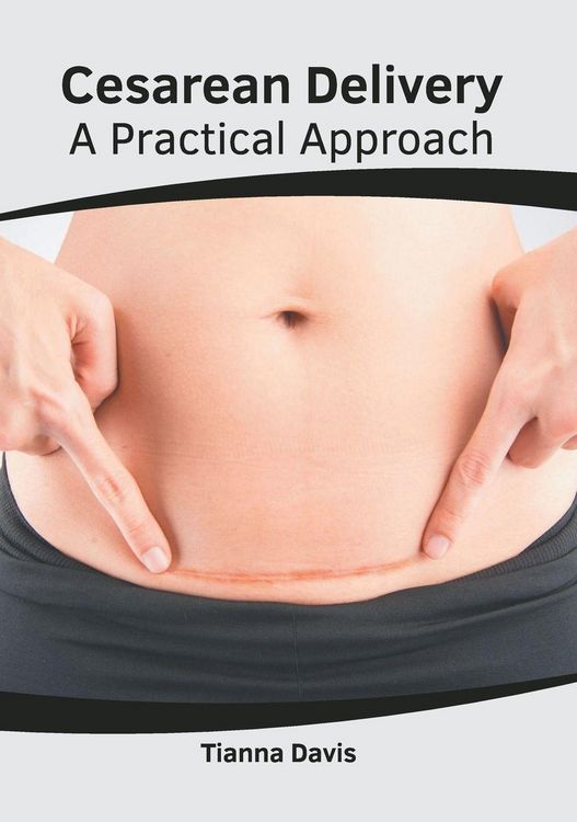 Produktbild: Cesarean Delivery: A Practical Approach