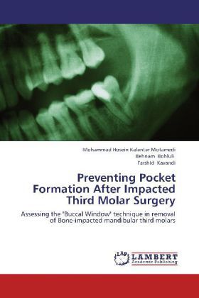 Produktbild: Kalantar Motamedi, M: Preventing Pocket Formation After Impa