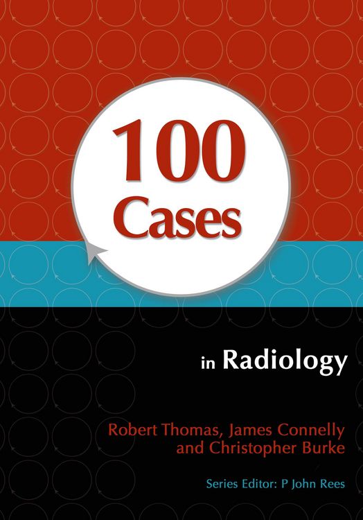 Produktbild: 100 Cases in Radiology