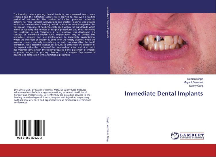 Produktbild: Immediate Dental Implants