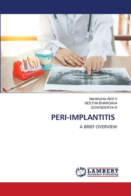 Produktbild: Peri-Implantitis