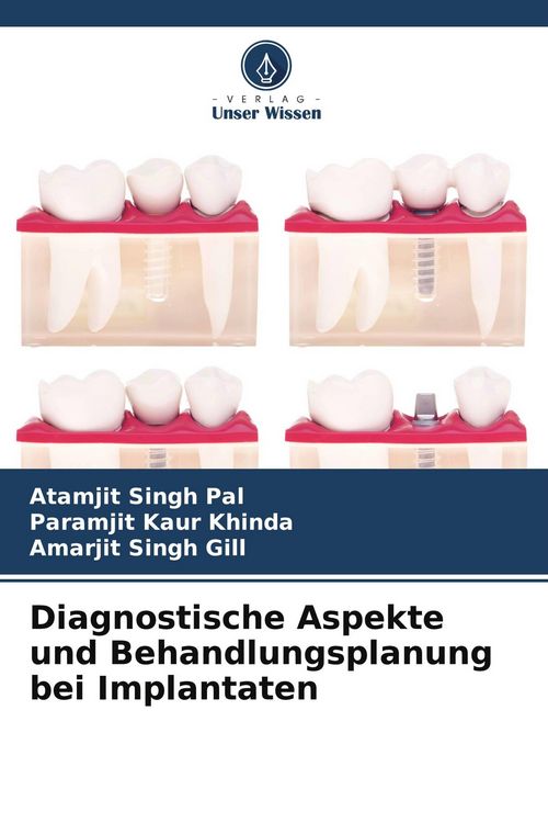 Produktbild: Diagnostische Aspekte und Behandlungsplanung bei Implantaten