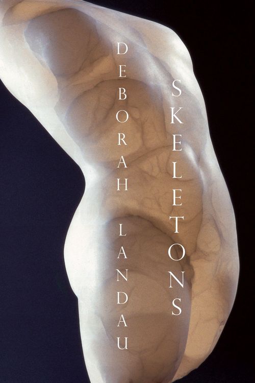Produktbild: Skeletons