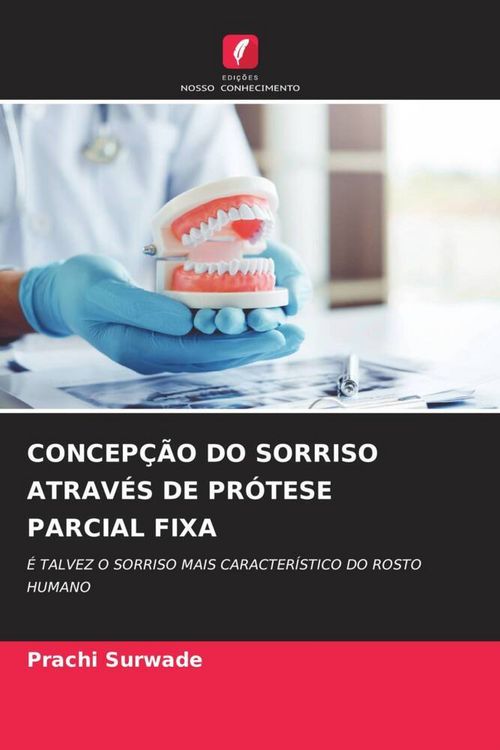 Produktbild: Concep&ccedil;&atilde;o Do Sorriso Atrav&eacute;s De Pr&oacute;tese Parcial Fixa