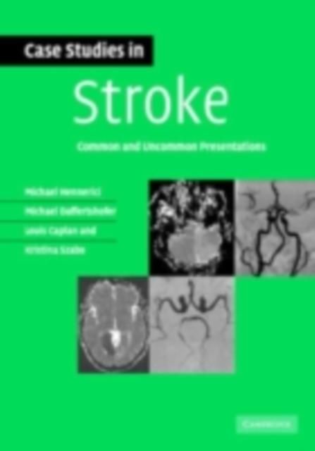 Produktbild: Case Studies in Stroke