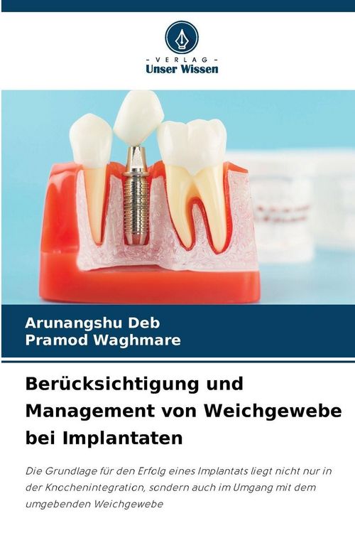 Produktbild: Ber&uuml;cksichtigung und Management von Weichgewebe bei Implantaten