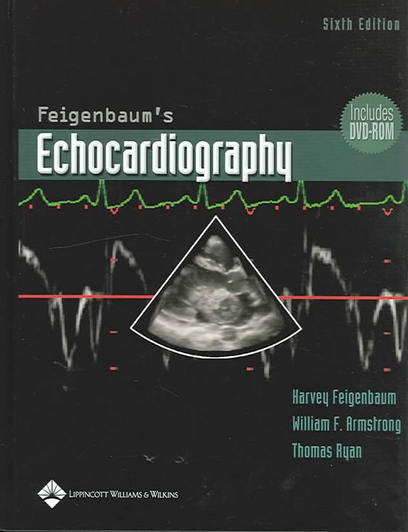 Produktbild: Feigenbaum's Echocardiography, w. DVD-ROM