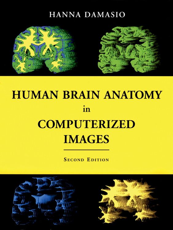 Produktbild: Human Brain Anatomy in Computerized Images
