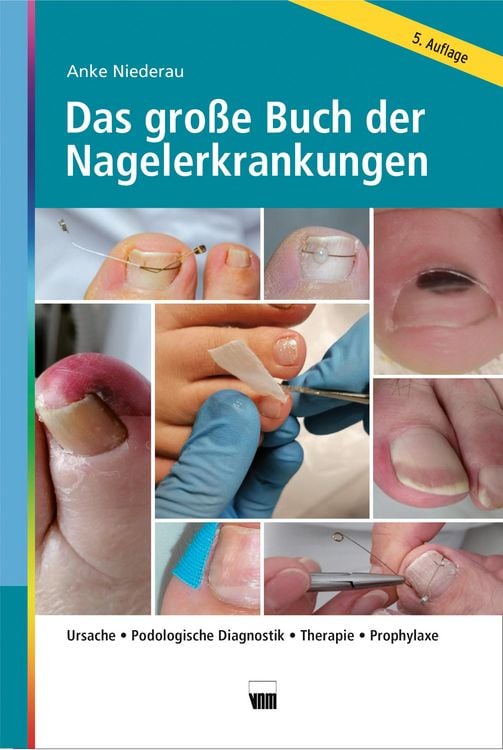 Produktbild: Das gro&szlig;e Buch der Nagelerkrankungen