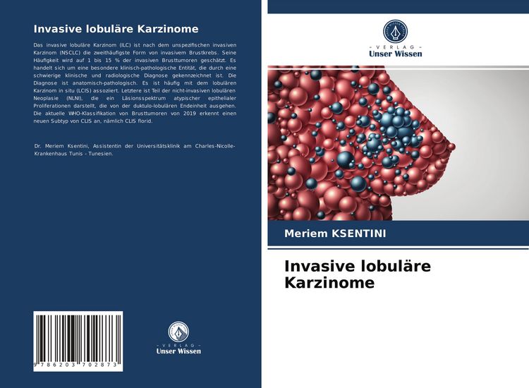 Produktbild: Invasive lobul&auml;re Karzinome