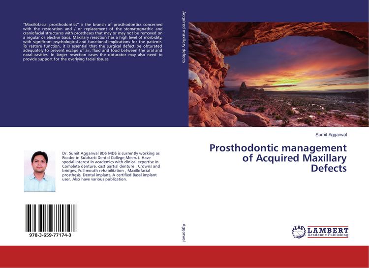 Produktbild: Prosthodontic management of Acquired Maxillary Defects