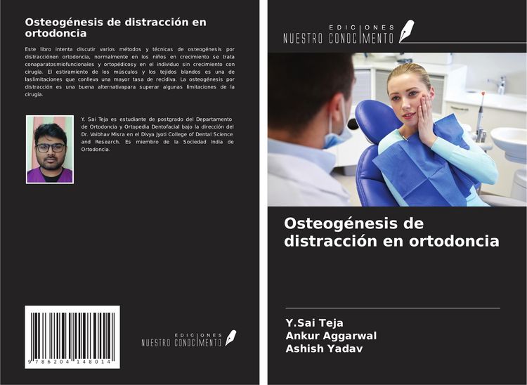 Produktbild: Osteog&eacute;nesis de distracci&oacute;n en ortodoncia