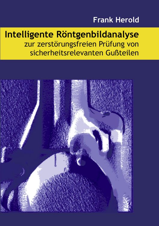 Produktbild: Intelligente R&ouml;ntgenbildanalyse zur zerst&ouml;rungsfreien Pr&uuml;fung von sicherheitsrelevanten Gu&szlig;teilen