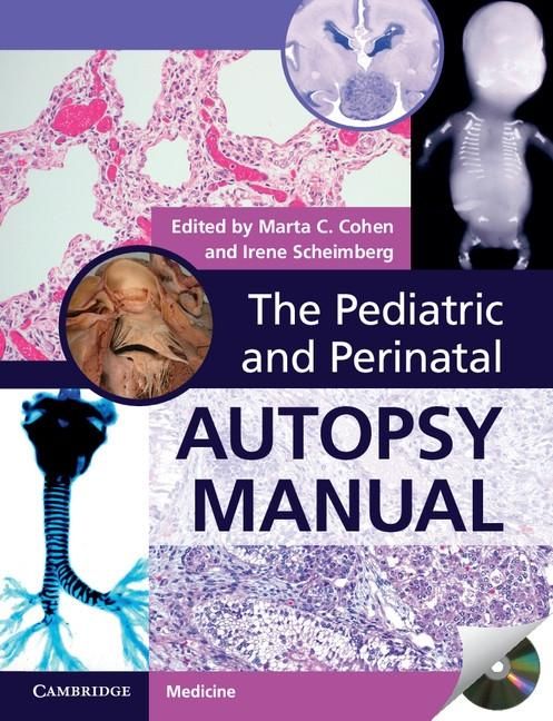 Produktbild: Pediatric and Perinatal Autopsy Manual