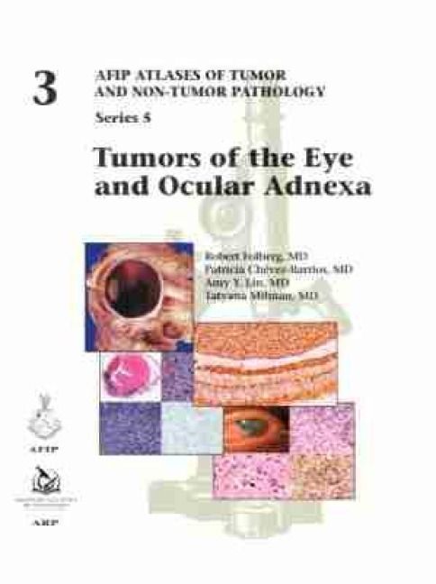 Produktbild: Tumors of the Eye and Ocular Adnexa