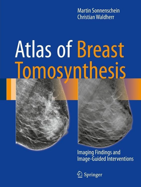 Produktbild: Atlas of Breast Tomosynthesis
