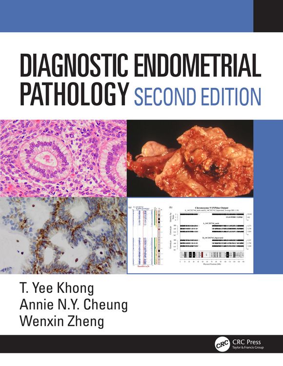 Produktbild: Diagnostic Endometrial Pathology 2E