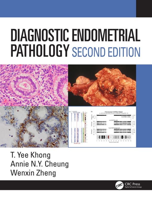 Produktbild: Diagnostic Endometrial Pathology 2E