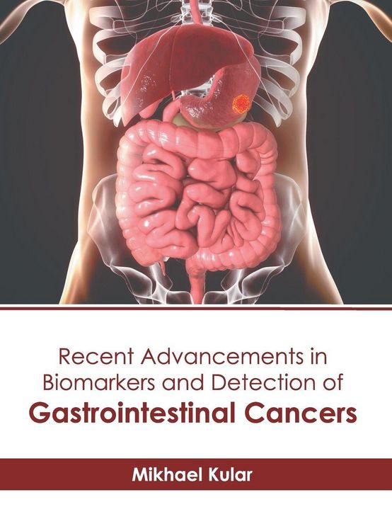 Produktbild: Recent Advancements in Biomarkers and Detection of Gastrointestinal Cancers
