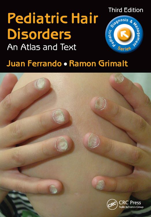 Produktbild: Pediatric Hair Disorders