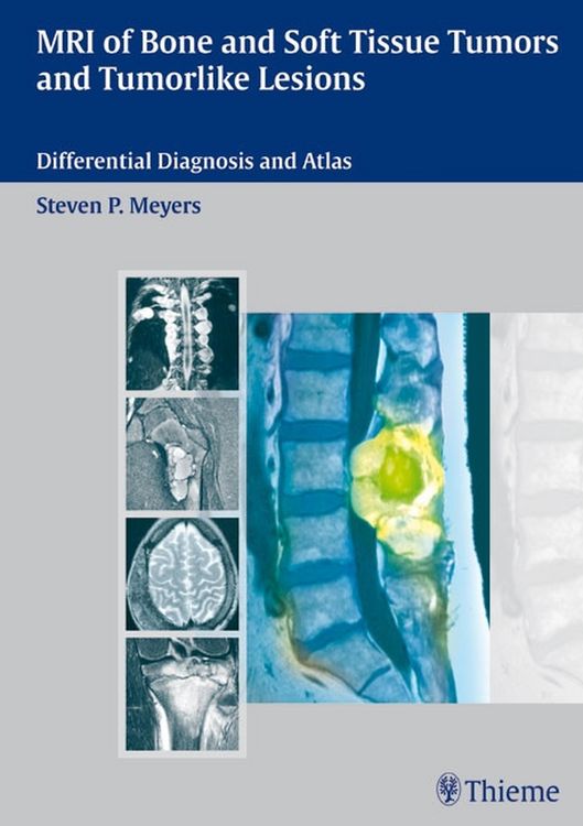 Produktbild: MRI of Bone and Soft Tissue Tumors and Tumorlike Lesions