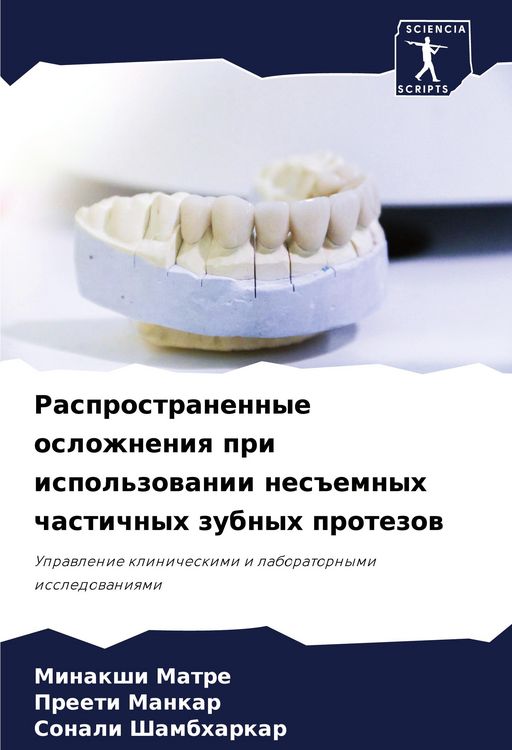 Produktbild: Rasprostranennye oslozhneniq pri ispol'zowanii nes#emnyh chastichnyh zubnyh protezow