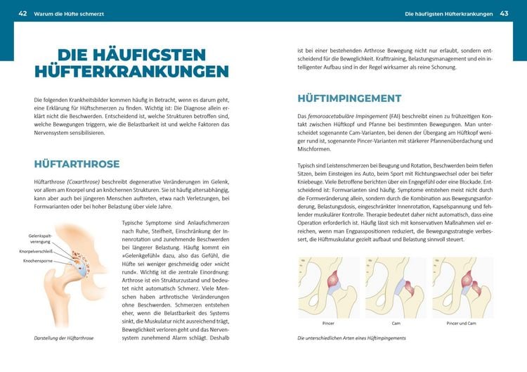 Produktbild: Neustart f&uuml;r die H&uuml;fte