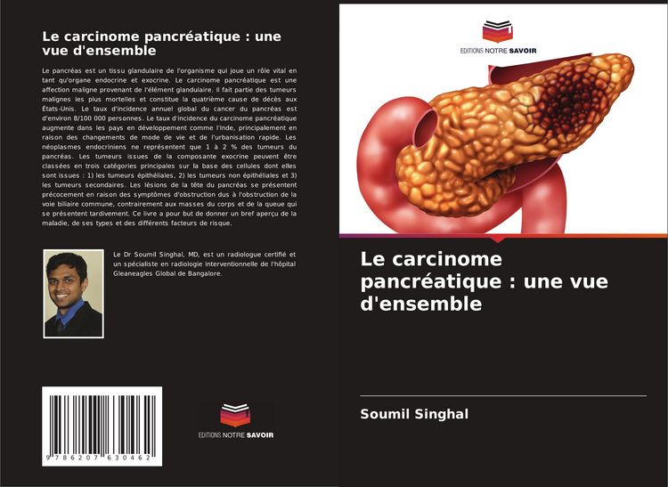 Produktbild: Le carcinome pancr&eacute;atique : une vue d'ensemble